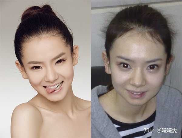 那些明星整过容,明星是不是都整过(大部分明星都整过容吗) 那些明星整过容,明星是不是都整过(大部分明星都整过容吗)