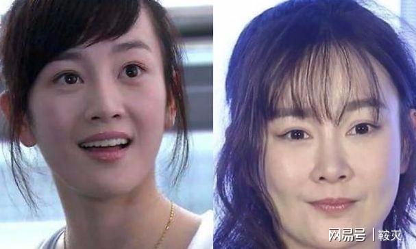 哪些明星整过容，整过容的明星(有哪些整过容的明星)