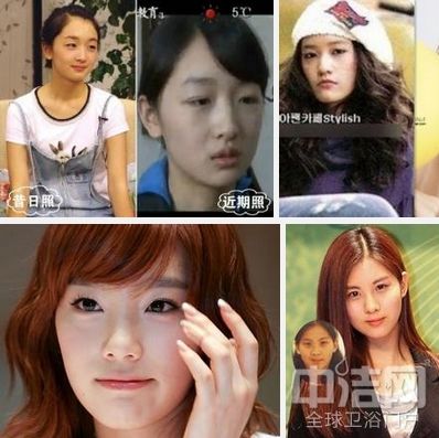 林允儿整容,全球最美100张面孔(林允最美面孔排名) 林允儿整容,全球最美100张面孔(林允最美面孔排名)