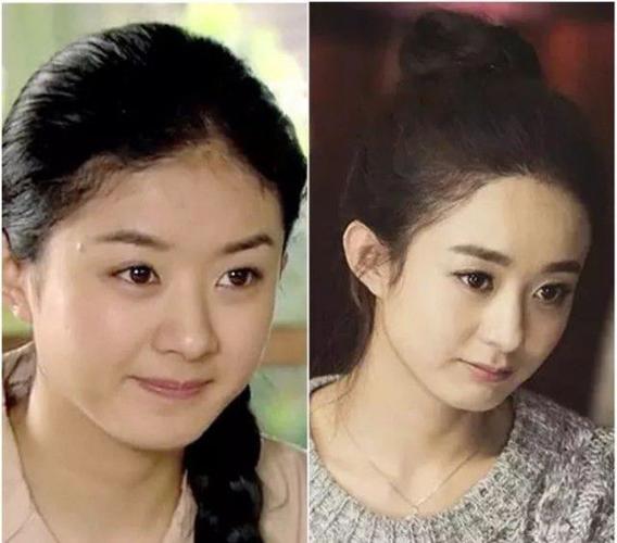 赵丽颖整容,超帅古装(赵丽颖的古装剧照片)