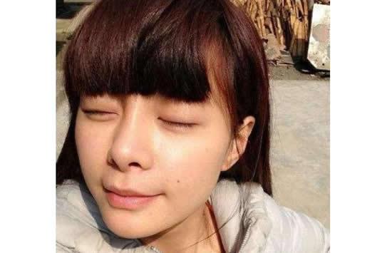 沈梦辰整容，鼻翼外扩图片(沈梦辰整容前后照片)