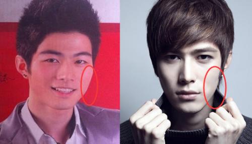 陈学冬整容前后,单眼皮陈学冬(陈学冬 整容前后)