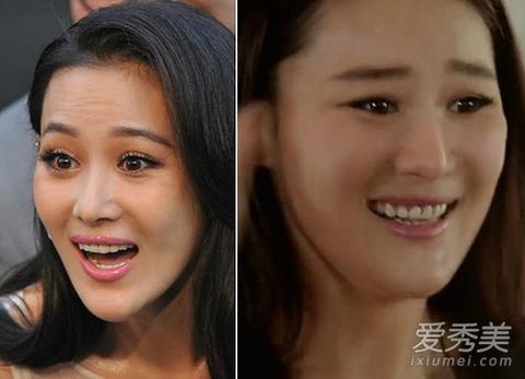 张馨予整容,何捷微博(何捷与张馨予结婚照)