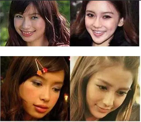 杨颖整容前后对比,Angelab(杨颖到底整过容吗)