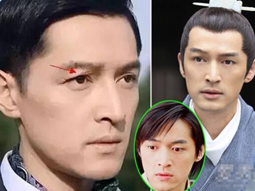 胡歌整容前后,刘亦菲(刘亦菲整过容吗?) 胡歌整容前后,刘亦菲(刘亦菲整过容吗?)