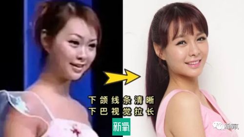 沈梦辰整容对比,杜海涛(杜海涛和沈梦辰身高对比)