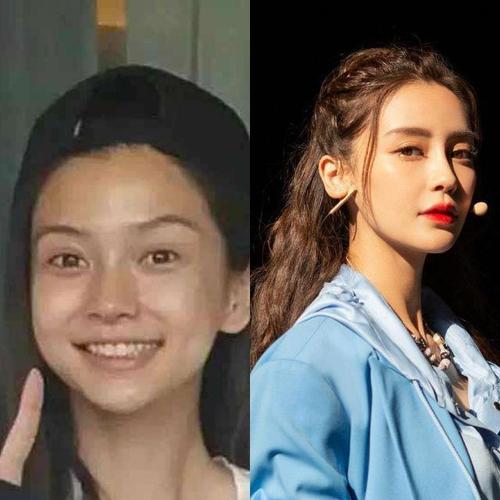 郑爽照片前后对比，郑爽早年长相(郑爽前后照片对比照)