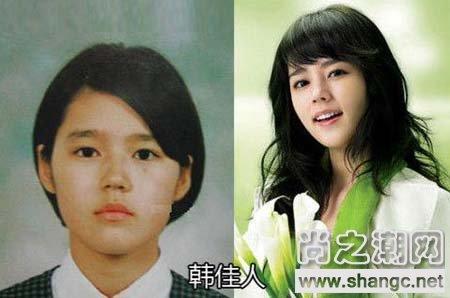 韩佳人整容前,韩佳人演过电影(韩佳人演技)