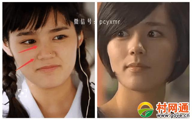 韩佳人整容前，韩佳人演过电影(韩佳人演技)