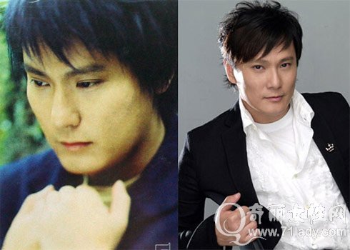 张信哲为老婆疯狂整容？张信哲整容前后照片(张信哲结婚了吗)