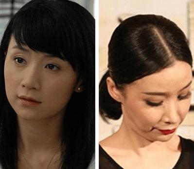 巩新亮整容前后，菊梓乔整容前(巩新亮为什么要整容)