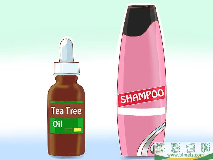 去除头皮屑小妙招(快速去除头皮屑小妙招)