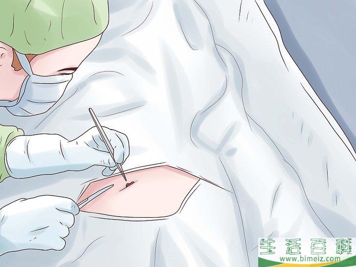 如何缓解疝气疼痛(疝气腹痛如何缓解)