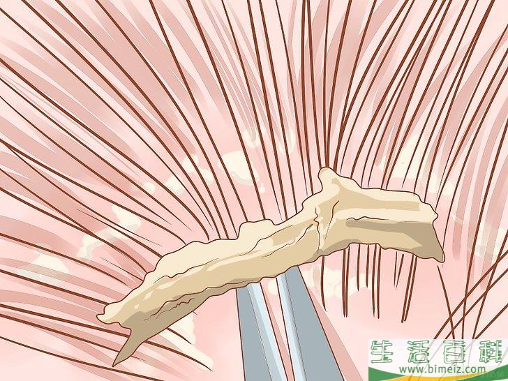 去除头皮屑小妙招(快速去除头皮屑小妙招) 去除头皮屑小妙招(快速去除头皮屑小妙招)