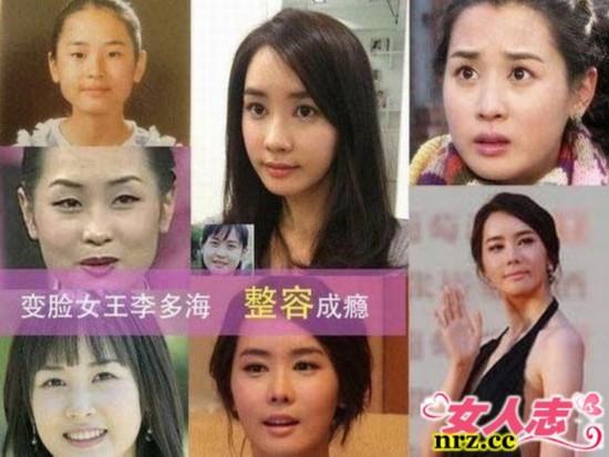 李多海整容前后,李多海最早照片(现在的李多海长什么样)