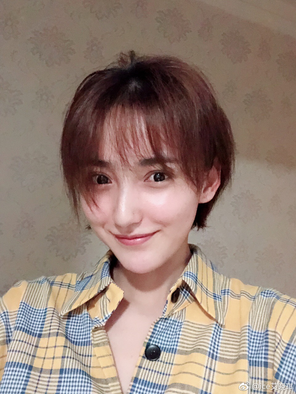 艾晓琪嘴歪是怎么回事 艾晓琪嘴歪是怎么回事