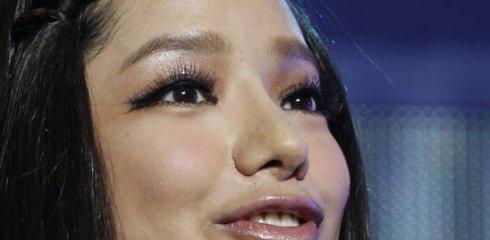 江映蓉整容前后,整容(江映蓉瘦的照片)