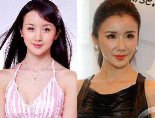 孙菲菲整容失败,李菲菲(孙菲菲什么时候整的容) 孙菲菲整容失败,李菲菲(孙菲菲什么时候整的容)