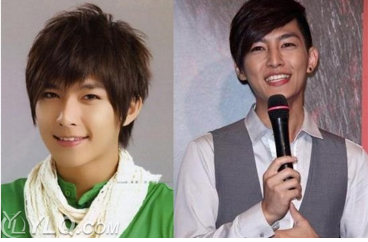 炎亚纶整容前后对比照片(炎亚纶什么脸型)