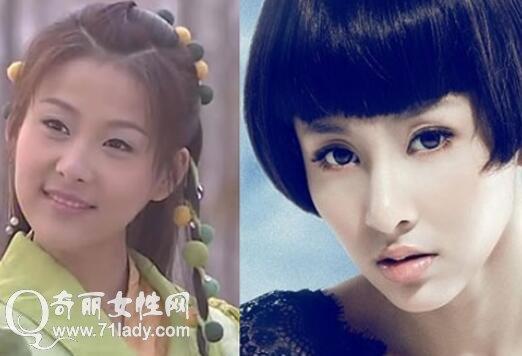 贾青整容前后，美容真心话贾青(贾青 整容前)