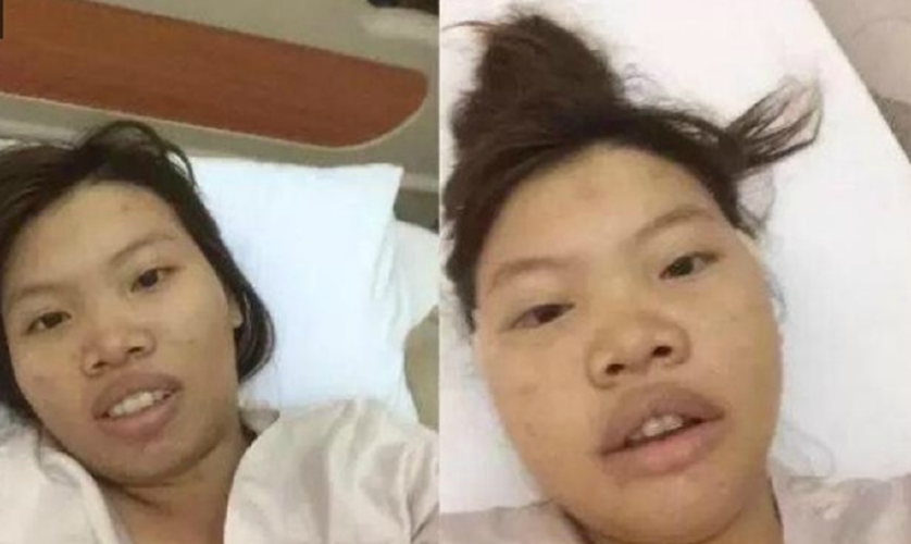 凤姐整容后的照片，弯弯姐整容前后(凤姐修图前后)