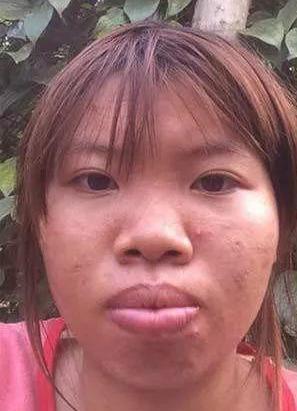 凤姐整容后照片对比,凤姐怎么火的(凤姐变漂亮) 凤姐整容后照片对比,凤姐怎么火的(凤姐变漂亮)