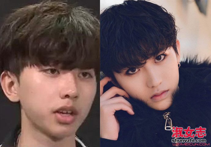 蔡徐坤的下巴是不是整容了？蔡徐坤整容前后