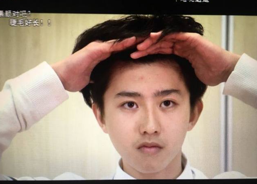 蔡徐坤的下巴是不是整容了？蔡徐坤整容前后