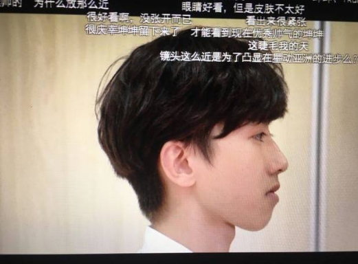 蔡徐坤的下巴是不是整容了？蔡徐坤整容前后