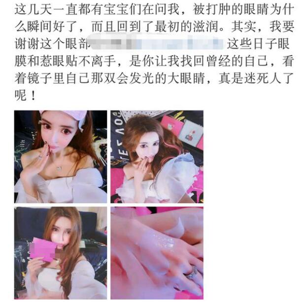 王瑞儿为什么被男友打 王瑞儿为什么被男友打