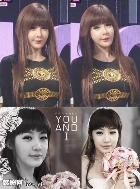 2ne1朴春承认自己整容(2ne1朴春唱法)