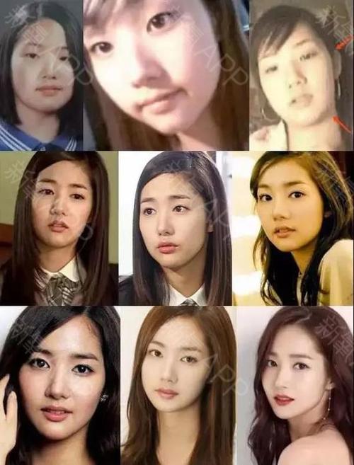 朴敏英整容前，肖战出道前照片(肖战核酸素颜照)