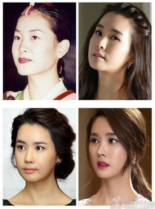 李多海整容前后,李多海最早照片(现在的李多海长什么样) 李多海整容前后,李多海最早照片(现在的李多海长什么样)