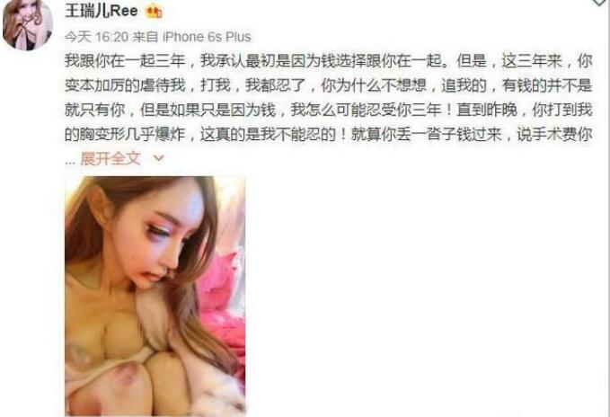 王瑞儿为什么被男友打 王瑞儿为什么被男友打