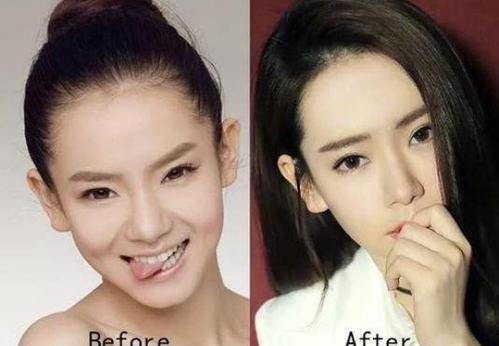 张檬整容前后照片对比,演员的诞生(张檬是哪一年整容的) 张檬整容前后照片对比,演员的诞生(张檬是哪一年整容的)