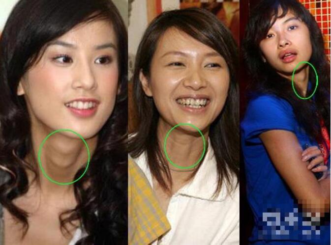 柴碧云为什么这么瘦还有喉结？女的到底有喉