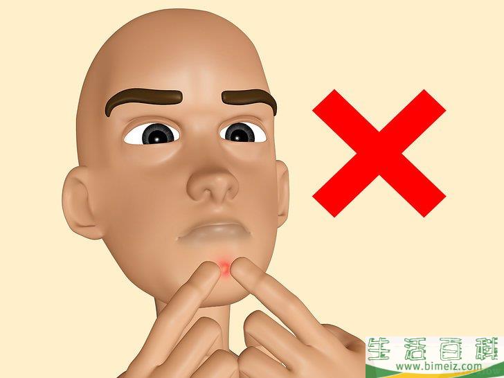 中学生青春痘怎么去除(中学生青春痘怎么去除视频)