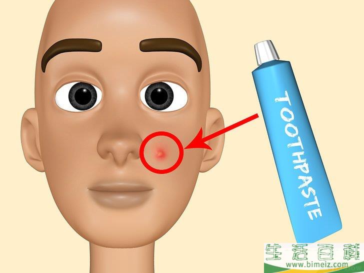 中学生青春痘怎么去除(中学生青春痘怎么去除视频)