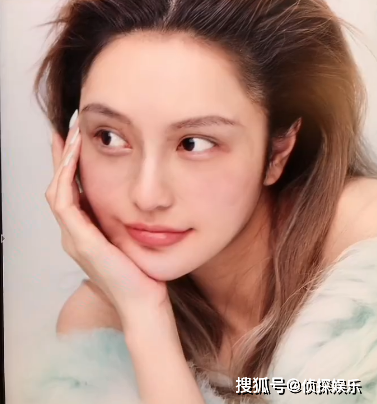 女星晒半脸瘀青照，眼袋淤青如何消(做眼袋脸上淤青多久能消除)