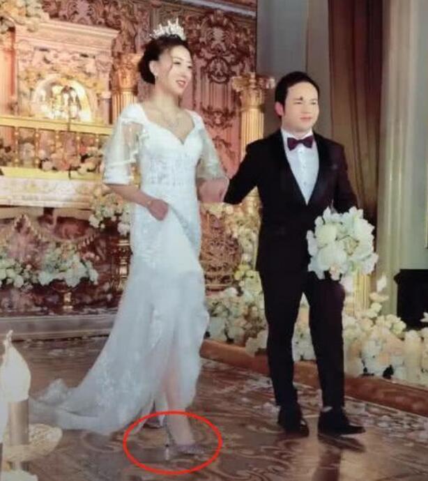 哈尼族王子祖传黑痣真的假的