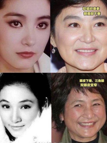 郑佩佩老公,郑沛琳是谁(郑佩佩近况) 郑佩佩老公,郑沛琳是谁(郑佩佩近况)