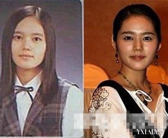 韩佳人整容前后，韩佳人近况(韩佳人现状)