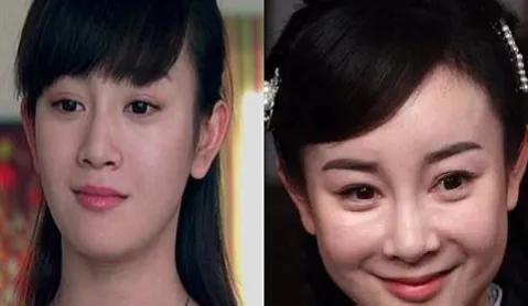 哪个明星整过容，哪些明星整过容名(明星谁整过容?)