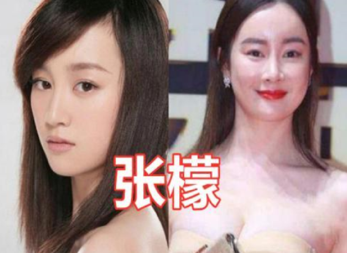 哪些女明星整过容,哪些明星整过容(明星整过容的都有哪些) 哪些女明星整过容,哪些明星整过容(明星整过容的都有哪些)