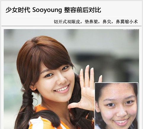 少女时代整容前照片,黑尾酱整容前