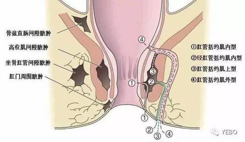 宋慧乔爆肛门是怎么回事，宋慧乔被