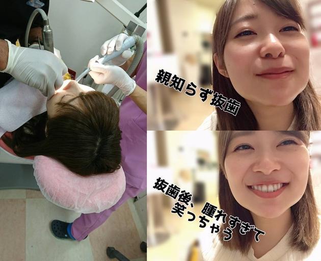 指原莉乃为什么叫指皇？指原莉乃整容前后对