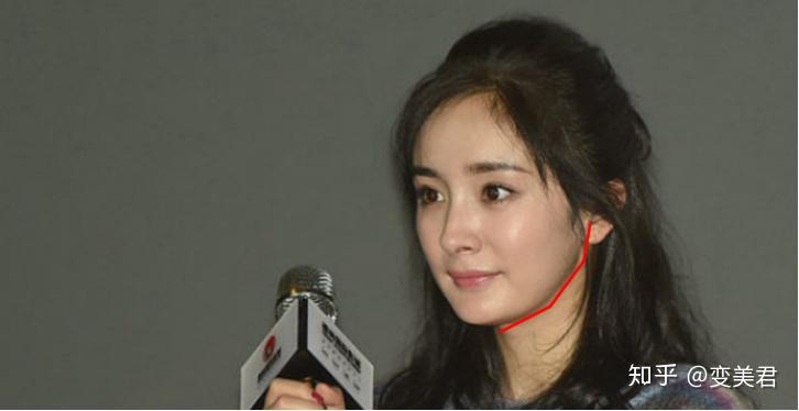 明星削骨，削骨失败图片(哪些明星承认削骨了)