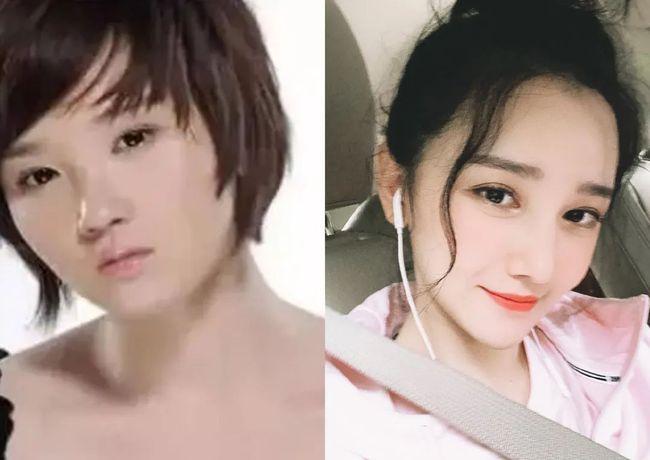 明星削骨,削骨失败图片(哪些明星承认削骨了)