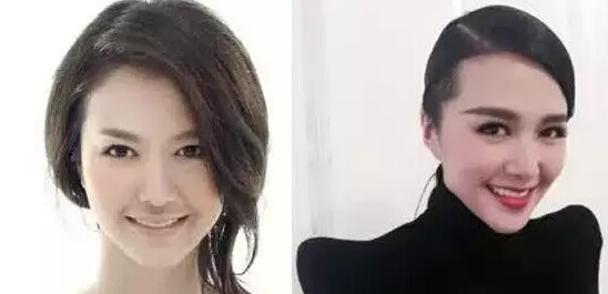谭维维整容前后照片(谭维维瘦了多少)